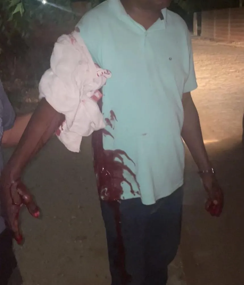 Homem de 52 anos é esfaqueado em suposto ataque homofóbico em Colônia do Piauí; suspeito está foragido — imagem 1