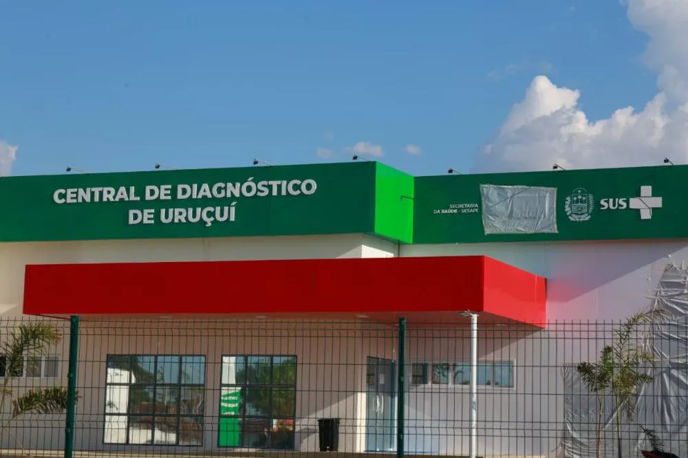 Uruçuí passa a contar Central de Diagnóstico