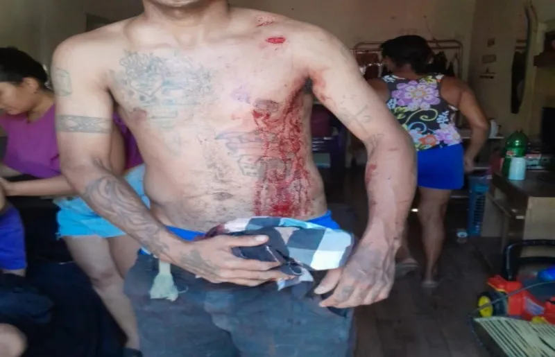 Homem é esfaqueado durante discussão na Rodagem de Floriano, em Oeiras